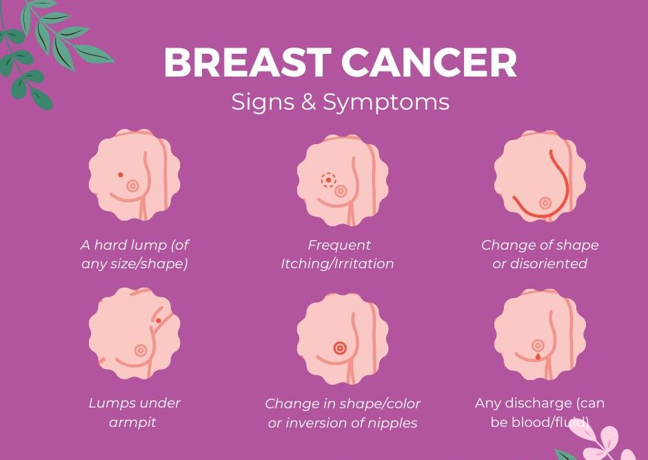 SYOK ENG - Breast cancer is the most common form of cancer
